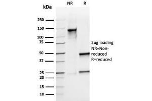 SDS-PAGE Analysis Purified S100A9 Recombinant Mouse Monoclonal Antibody (rMAC3781). (Recombinant S100A8 antibody)