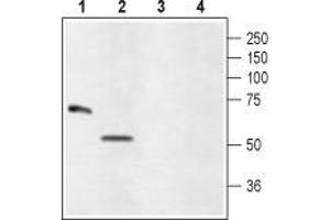 Western blot analysis of rat eye (lanes 1 and 3) and ARPE-19 (lanes 2 and 4) lysates: - 1,2. (GLRA4 antibody  (Extracellular, N-Term))