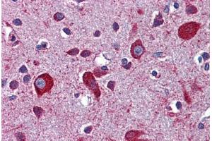 Human Brain, Cortex: Formalin-Fixed, Paraffin-Embedded (FFPE) (LRP8 antibody  (AA 395-444))