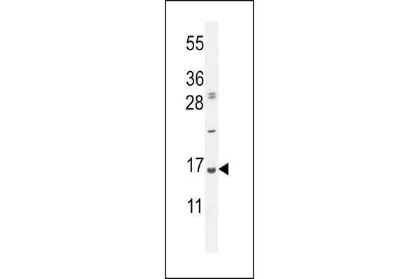 UBA52 anticorps  (C-Term)