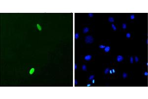 Immunocytochemistry/Immunofluorescence analysis using Mouse Anti-DUX4 Monoclonal Antibody, Clone P2B1 (ABIN863109). (DUX4 antibody  (C-Term))