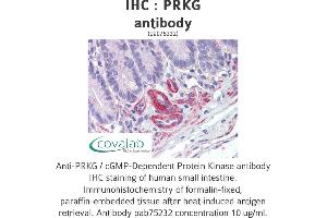 Image no. 1 for anti-PRKG antibody (ABIN1738352) (PRKG antibody)