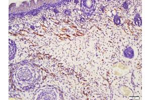 Formalin-fixed and paraffin embedded muscle of mouse embryo labeled with Anti-TAGL2 Polyclonal Antibody, Unconjugated (ABIN682423) at 1:200 followed by conjugation to the secondary antibody and DAB staining (TAGLN2 antibody  (AA 51-160))