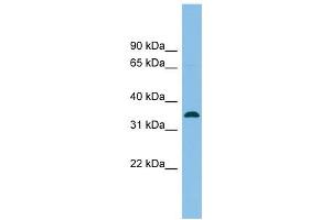 SRR antibody used at 1 ug/ml to detect target protein. (SRR antibody  (Middle Region))