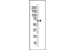 Western blot analysis of anti-GRK5 Pab in HeLa cell lysate (Lane 1) and mouse brain tissue lysate (Lane 2). (GRK5 antibody  (C-Term))