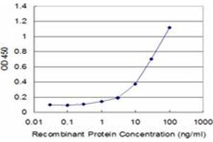 Detection limit for recombinant GST tagged EXOSC10 is approximately 1ng/ml as a capture antibody. (EXOSC10 antibody  (AA 1-99))