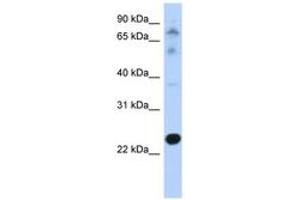 Image no. 1 for anti-Cysteine-Rich Hydrophobic Domain 2 (CHIC2) (N-Term) antibody (ABIN6743442) (CHIC2 antibody  (N-Term))