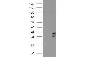 HEK293T cells were transfected with the pCMV6-ENTRY control (Left lane) or pCMV6-ENTRY CXorf26 (Right lane) cDNA for 48 hrs and lysed. (CXorf26 antibody)