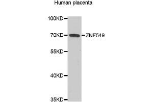 Western blot analysis of extracts of human placenta, using ZNF549 antibody. (ZNF549 antibody)