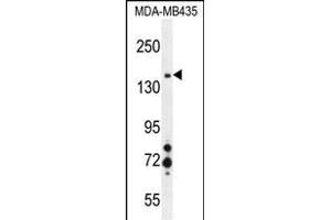 MET Antibody (ABIN1881539 and ABIN2845394) western blot analysis in MDA-M cell line lysates (35 μg/lane).