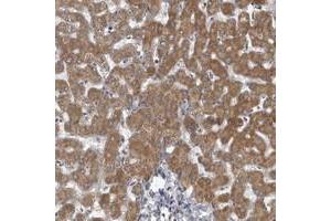 Immunohistochemical staining of human liver with LYSMD1 polyclonal antibody  shows moderate cytoplasmic positivity in hepatocytes. (LYSMD1 antibody)