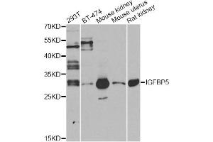 Western blot analysis of extracts of various cell lines, using IGFBP5 antibody. (IGFBP5 antibody)