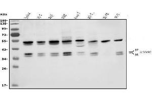 Western blot analysis of HNRNPH3 using anti-HNRNPH3 antibody (ABIN7601121). (HNRNPH3 antibody  (AA 29-268))