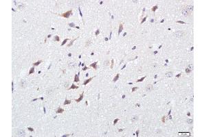 Paraformaldehyde-fixed, paraffin embedded rat brain, Antigen retrieval by boiling in sodium citrate buffer (pH6) for 15min, Block endogenous peroxidase by 3% hydrogen peroxide for 30 minutes, Blocking buffer (normal goat serum) at 37°C for 20min, Antibody incubation with GPM6B Polyclonal Antibody, Unconjugated  at 1:500 overnight at 4°C, followed by a conjugated secondary and DAB staining (GPM6B antibody  (AA 1-100))