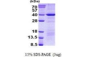 Figure annotation denotes ug of protein loaded and % gel used. (DEDD Protein)