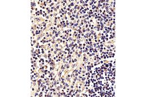 (ABIN6242561 and ABIN6577995) staining STAT5A in Human thymus tissue sections by Immunohistochemistry (IHC-P - paraformaldehyde-fixed, paraffin-embedded sections). (STAT5A antibody  (C-Term))
