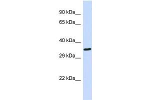 Host: Rabbit Target Name: EWSR1 Sample Type: 721_B Whole cell lysates Antibody Dilution: 1.