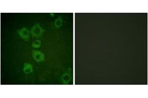 Immunofluorescence analysis of HuvEc cells, using Caspase 6 (Ab-257) Antibody. (Caspase 6 antibody  (AA 223-272))