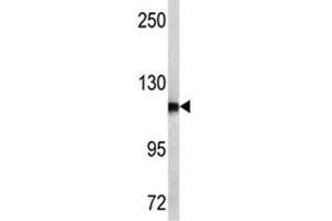 Western blot analysis of NPEPPS antibody and MCF-7 lysate. (NPEPPS antibody  (AA 709-737))