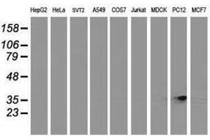 Image no. 3 for anti-Retinol Dehydrogenase 14 (All-Trans/9-Cis/11-Cis) (RDH14) antibody (ABIN1500656) (RDH14 antibody)