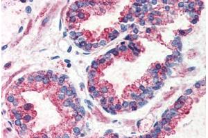 Prostate, Human: Formalin-Fixed, Paraffin-Embedded (FFPE) (G Protein-Coupled Receptor 126 antibody  (N-Term))