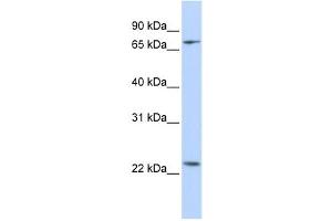 Western Blotting (WB) image for anti-Zinc Finger Protein 185 (ZNF185) antibody (ABIN2458345) (Zinc Finger Protein 185 antibody)