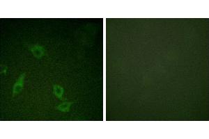 Peptide - +Immunofluorescence analysis of HeLa cells, using FAK (Ab-397) antibody. (FAK antibody  (Tyr397))