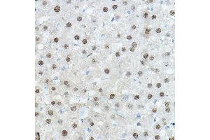 Immunohistochemistry of paraffin-embedded Mouse liver using CEBPA Rabbit pAb (ABIN6131380, ABIN6138380, ABIN6138381 and ABIN6214018) at dilution of 1:100 (40x lens). (CEBPA antibody  (AA 1-205))