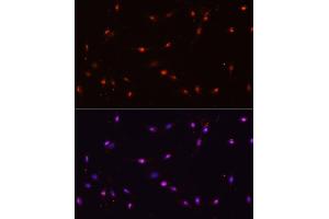 Immunofluorescence analysis of C6 cells using ILF3 antibody (ABIN3023309, ABIN3023310, ABIN3023311 and ABIN6219571) at dilution of 1:100. (Interleukin enhancer-binding factor 3 (ILF3) (AA 1-270) antibody)