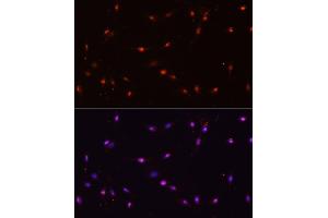 Immunofluorescence analysis of C6 cells using ILF3 antibody (ABIN3023309, ABIN3023310, ABIN3023311 and ABIN6219571) at dilution of 1:100. (Interleukin enhancer-binding factor 3 (ILF3) (AA 1-270) antibody)