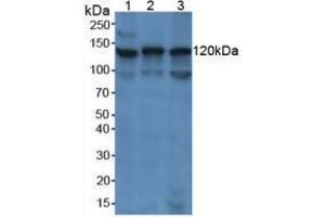 Western blot analysis of (1) Human Jurkat Cells, (2) Human K562 Cells and (3) Human Raji Cells. (PARP1 antibody  (AA 661-881))