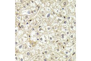 Immunohistochemistry of paraffin-embedded liver injury using LMNB2 antibody at dilution of 1:200 (400x lens). (Lamin B2 antibody)