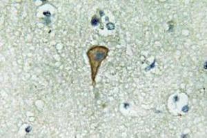 Immunohistochemistry (IHC) analyzes of IL-20Ralpha antibody in paraffin-embedded human brain tissue. (IL20RA antibody)