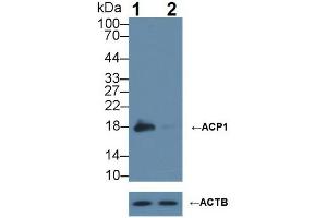 Western blot analysis of (1) Wild-type HeLa cell lysate, and (2) ACP1 knockout HeLa cell lysate, using Rabbit Anti-Rat ACP1 Antibody (1 µg/ml) and HRP-conjugated Goat Anti-Mouse antibody (