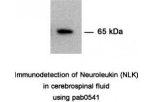 Image no. 1 for anti-Glucose-6-Phosphate Isomerase (GPI) antibody (ABIN347737) (GPI antibody)