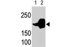 LRP5 polyclonal antibody  is used in Western blot to detect recombinant human LRP5 (Lane 1) and mouse LRP5 (Lane 2) proteins in transfected 293 cell lysates. (LRP5 antibody  (C-Term))