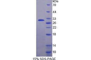 Image no. 1 for Kallikrein 10 (KLK10) (AA 35-276) protein (His tag) (ABIN6236684) (Kallikrein 10 Protein (KLK10) (AA 35-276) (His tag))