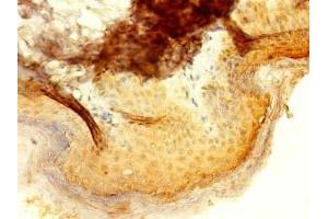 Immunohistochemistry of paraffin-embedded human skin tissue using ABIN7156675 at dilution of 1:100 (IFIT5 antibody  (AA 107-320))