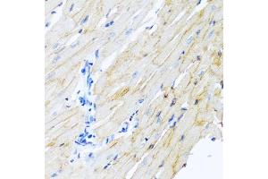 Immunohistochemistry of paraffin-embedded rat heart using ADAM17 antibody. (ADAM17 antibody)