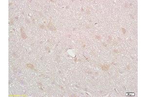 Formalin-fixed and paraffin embedded rat brain tissue labeled with Anti-DRD2 Polyclonal Antibody, Unconjugated  at 1:200, followed by conjugation to the secondary antibody and DAB staining (Dopamine d2 Receptor antibody  (AA 201-300))