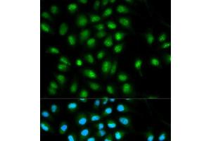 Immunofluorescence analysis of HeLa cells using ASC / TMS1 Polyclonal Antibody (PYCARD antibody)