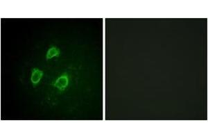 Immunofluorescence analysis of HepG2 cells, using Kv2. (Kv2.1/KCNB1 antibody  (pSer567))