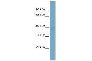 WB Suggested Anti-CXorf66 Antibody Titration:  0. (CXorf66 antibody  (Middle Region))