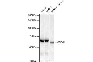 Western blot analysis of extracts of various cell lines, using Z antibody (ABIN7271430) at 1:1000 dilution. (ZAP70 antibody)