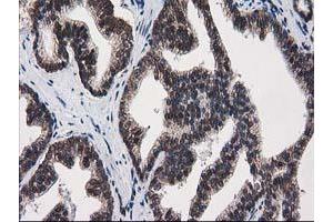Image no. 1 for anti-Protein Kinase C, epsilon (PRKCE) antibody (ABIN1500228) (PKC epsilon antibody)