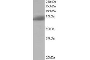 ABIN2559911 staining (1µg/ml) of Human Brain lysate (RIPA buffer, 35µg total protein per lane). (SH3BP1 antibody  (C-Term))