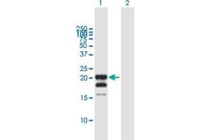 Western Blot analysis of IFNG expression in transfected 293T cell line by IFNG MaxPab polyclonal antibody. (Interferon gamma antibody  (AA 1-166))