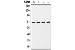 Western blot analysis of CHRNA7 expression in HepG2 (A), Jurkat (B), Raw264. (CHRNA7 antibody  (Center))