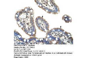 Human Intestine (DMP1 antibody  (C-Term))