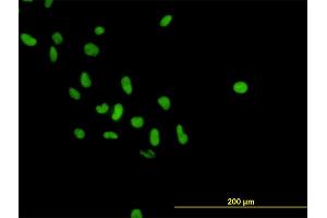 Immunofluorescence of monoclonal antibody to PARP1 on HeLa cell. (PARP1 antibody  (AA 1-100))